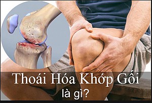 THOÁI HÓA KHỚP GỐI: NGUYÊN NHÂN, TRIỆU CHỨNG, CHẨN ĐOÁN VÀ ĐIỀU TRỊ