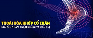 THOÁI HÓA KHỚP CỔ CHÂN: NGUYÊN NHÂN, DẤU HIỆU, ĐIỀU TRỊ, PHÒNG NGỪA