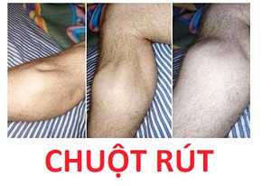 CHUỘT RÚT