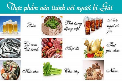 Dinh Dưỡng Thông Minh và Vận Động Tối Ưu Cho Người Bị Gout