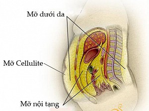Cân nặng không đổi, vì sao bụng vẫn to dần?