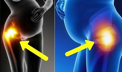 Các Tư Thế Yoga Hỗ Trợ Giảm Đau Khớp Háng Cho Mẹ Bầu